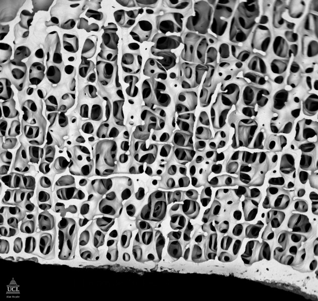 Image result for microscope art from bones